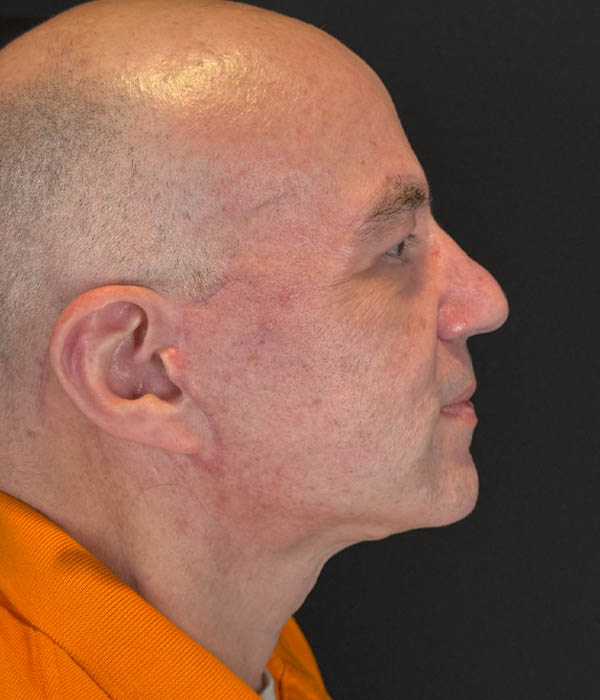 1_0025_flift (5).HEIC