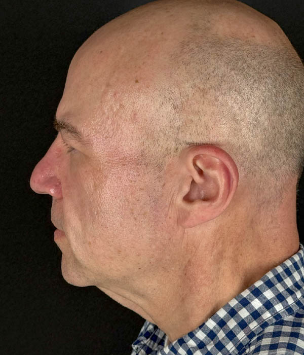 1_0026_flift (8).HEIC