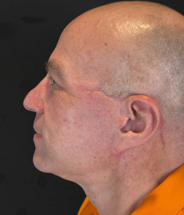 1_0027_flift (7).HEIC